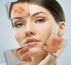 skin treatment in dubai
